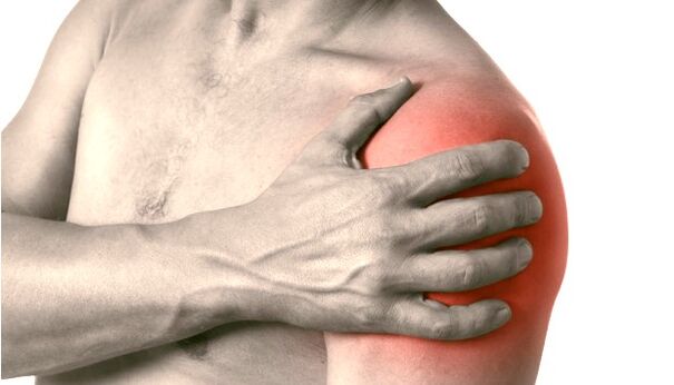 Swollen, red and enlarged shoulder - symptoms of grade 2-3 osteoarthritis of the shoulder joint