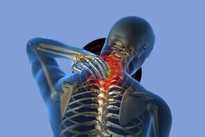 Symptoms of cervical osteochondryosis