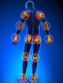 Detection of joints affected by arthritis