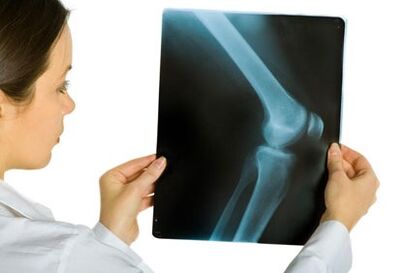 Treatment of the articulation of the knee joint