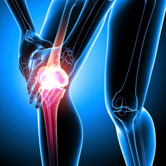 Rheumatoid arthritis in advanced stage can cause hip pain